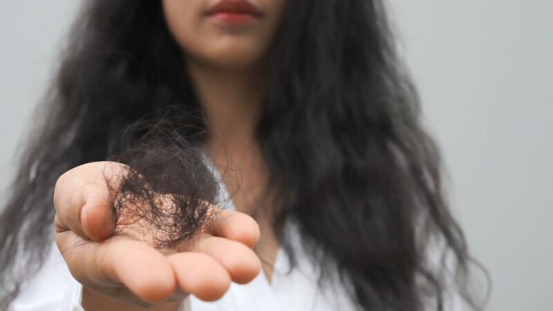 Queda de cabelo pós-parto: médica explica o que é normal e quando investigar Queda de cabelo pós-parto: médica explica o que é normal e quando investigar